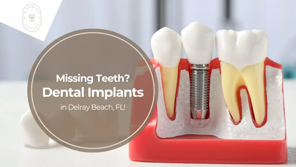 DENTAL IMPLANTS - BIO SMILE